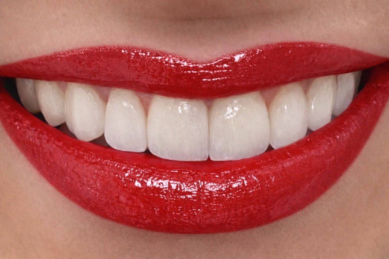 Resultado de sonrisa