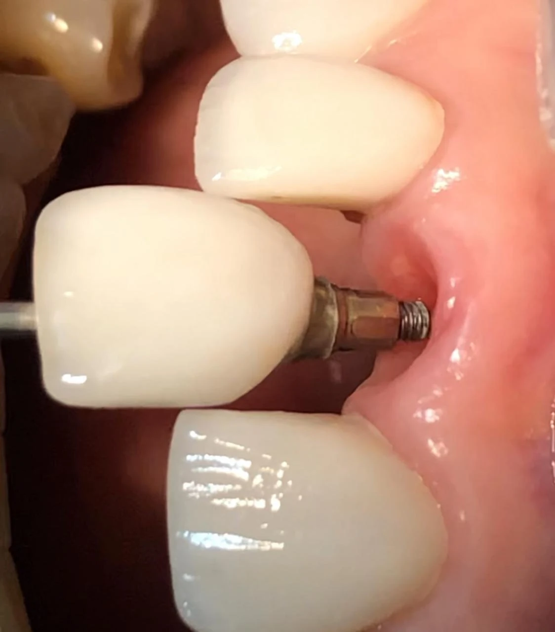 Fotografía clínica dental