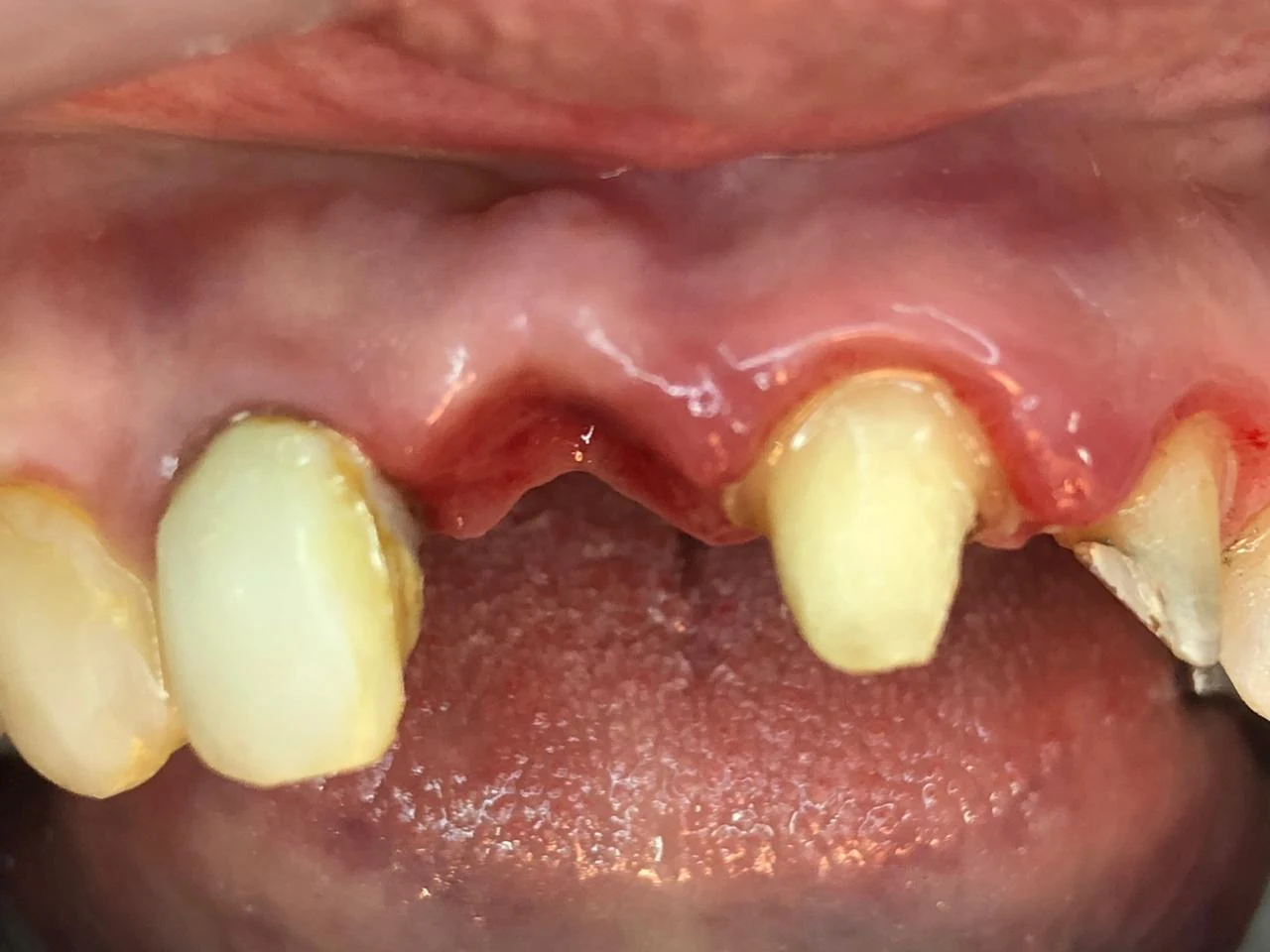 Fotografía clínica dental
