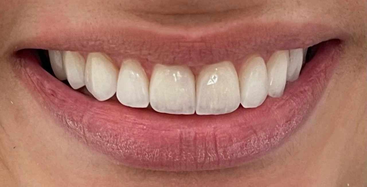 Fotografía clínica dental