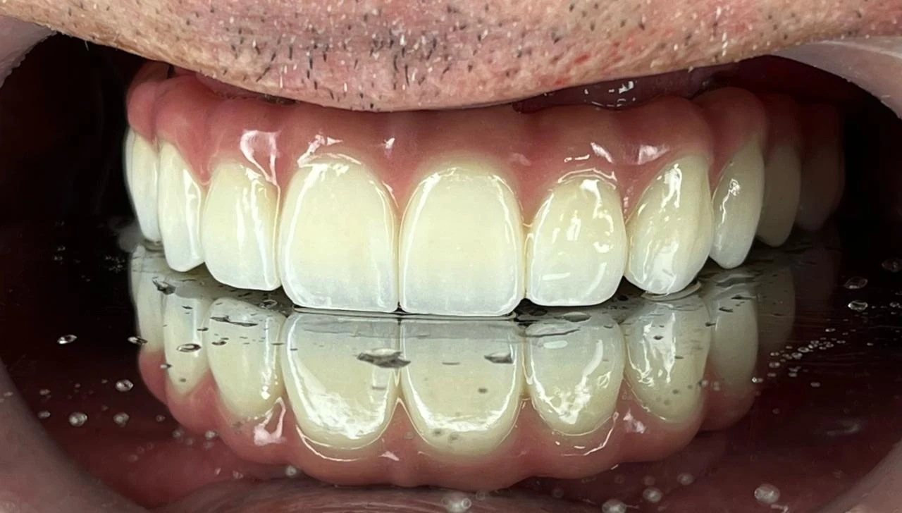 Fotografía clínica dental