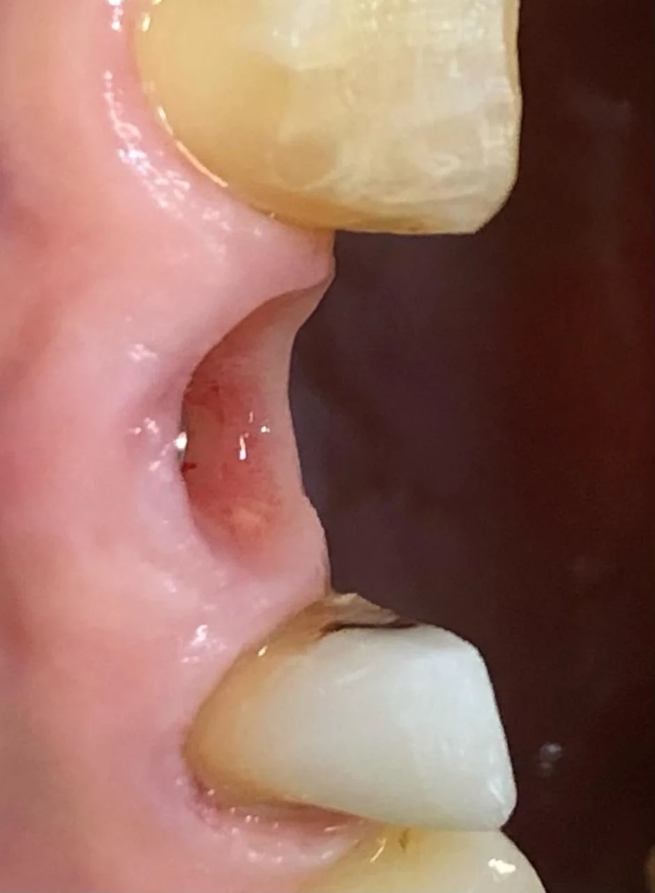 Fotografía clínica dental