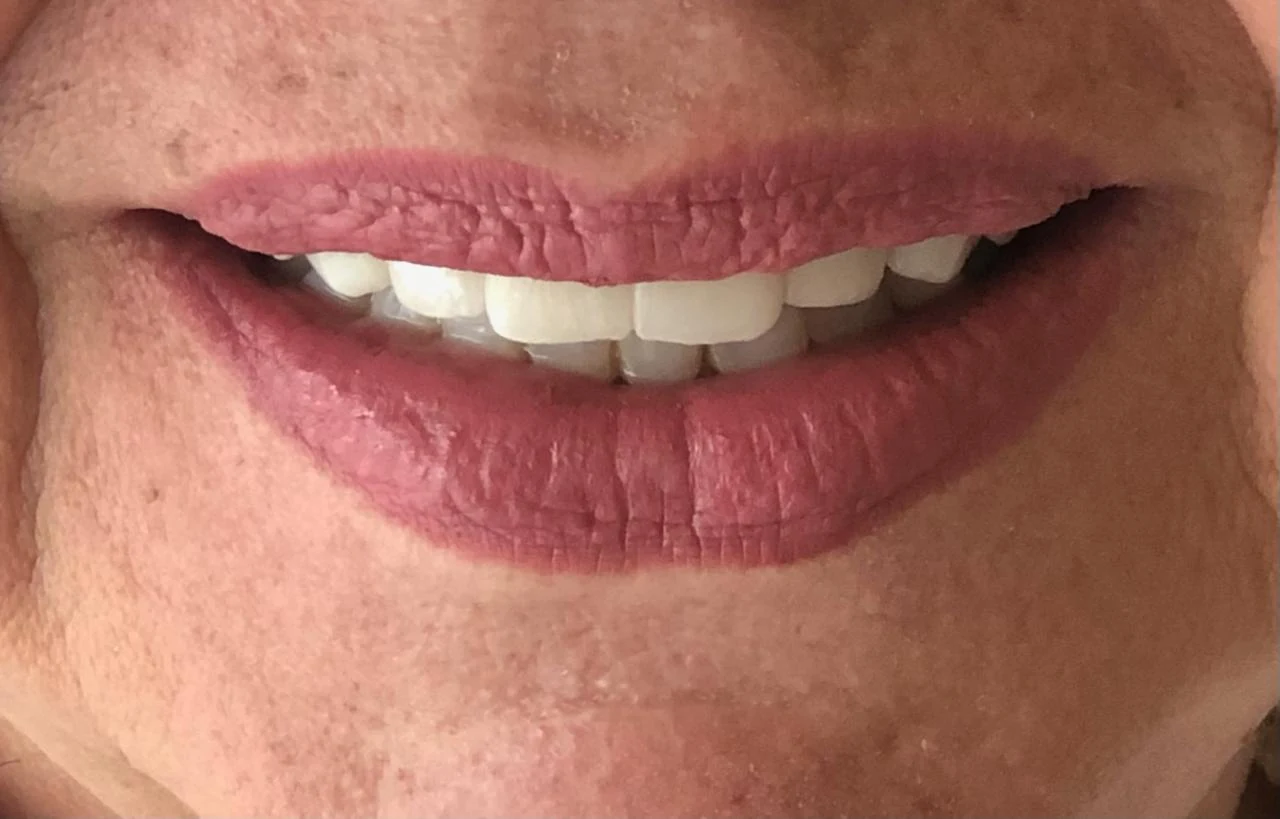 Fotografía clínica dental