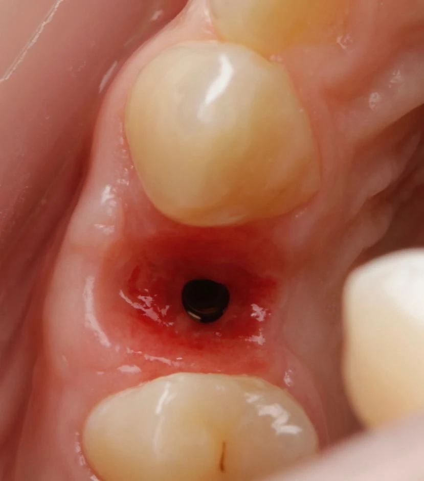 Fotografía clínica dental