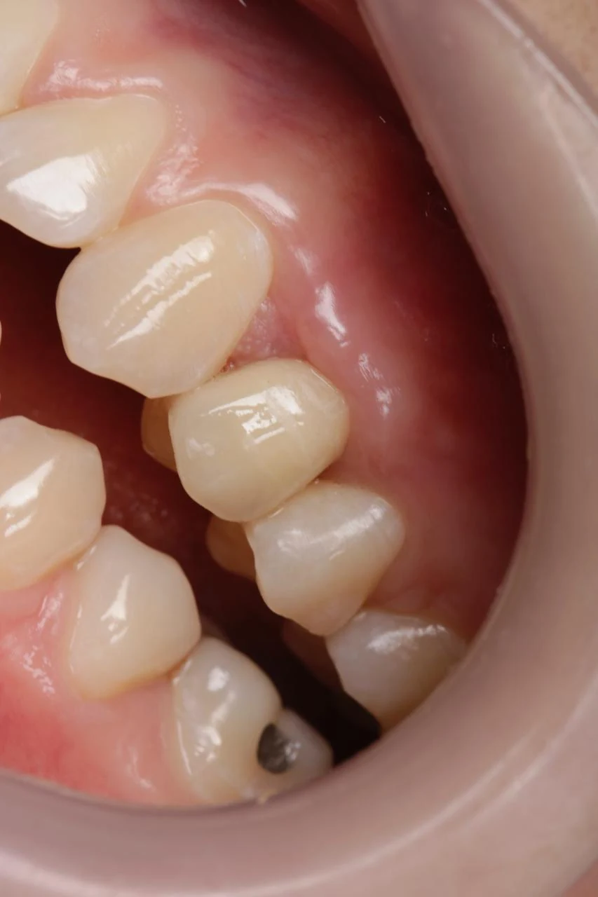 Fotografía clínica dental