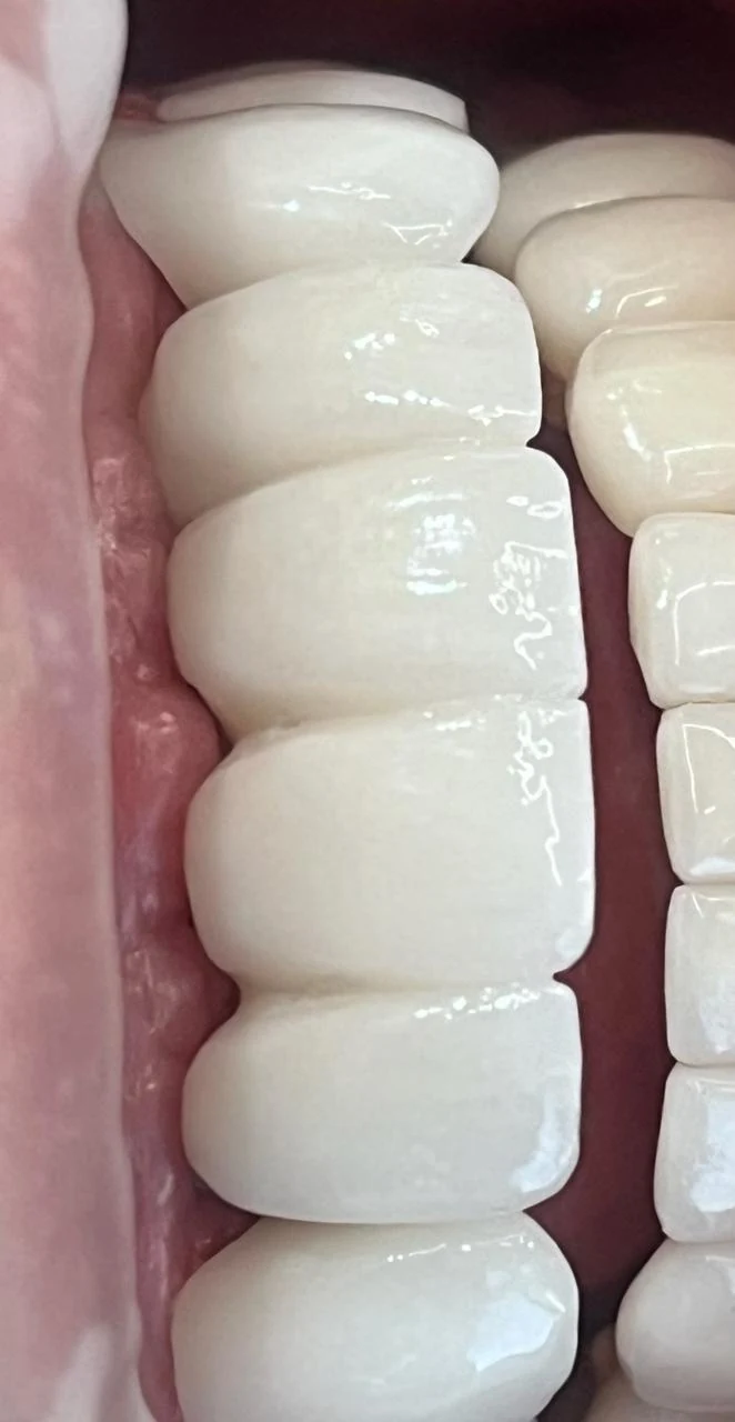 Fotografía clínica dental