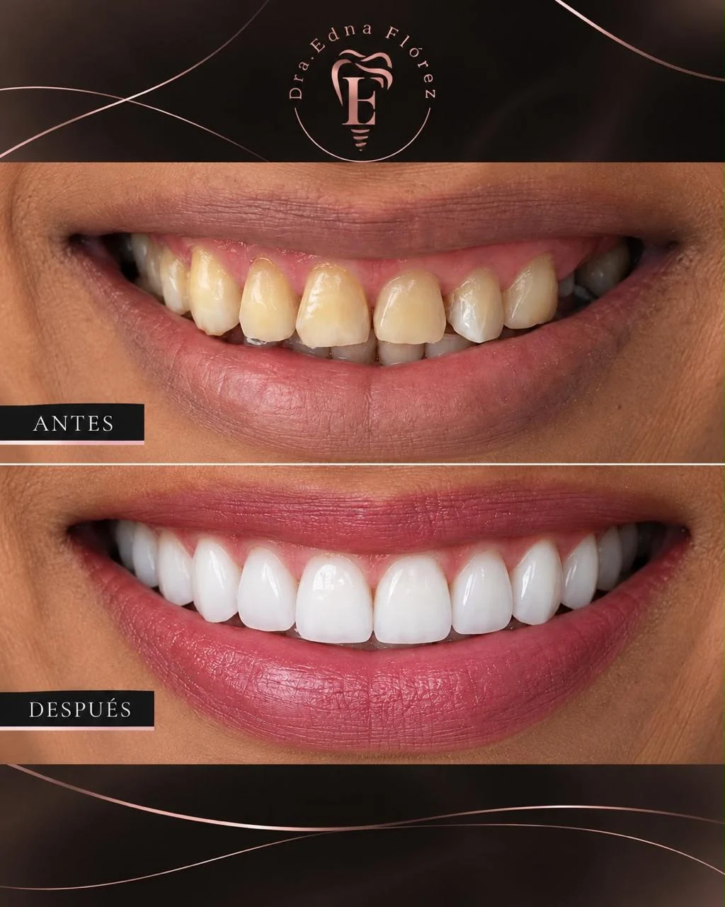 Fotografía clínica dental