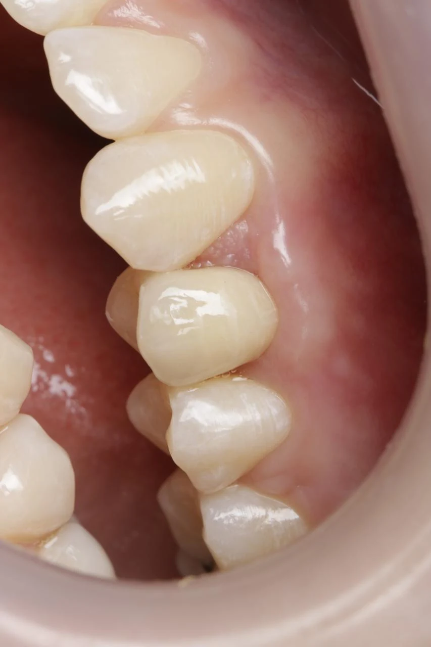 Fotografía clínica dental
